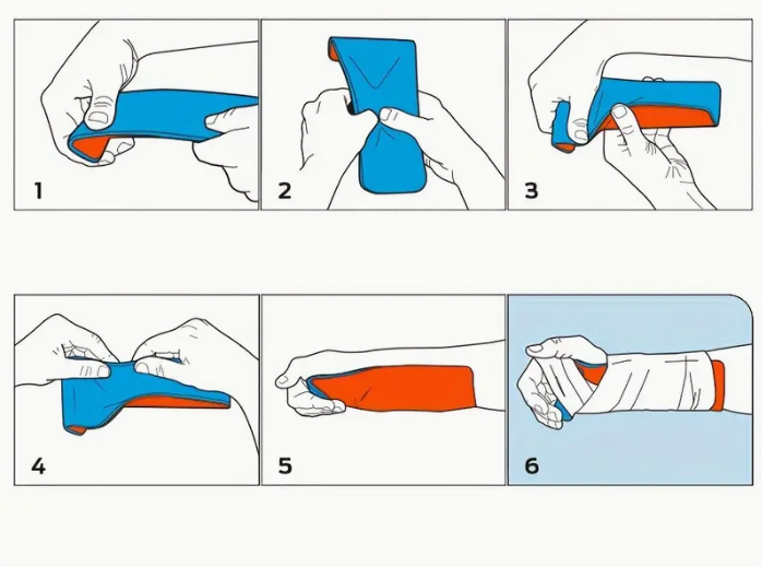 Polymer Splint
